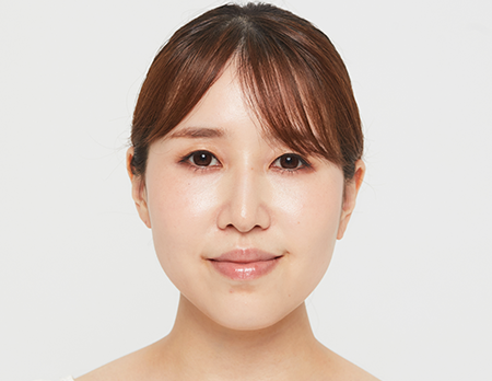 After