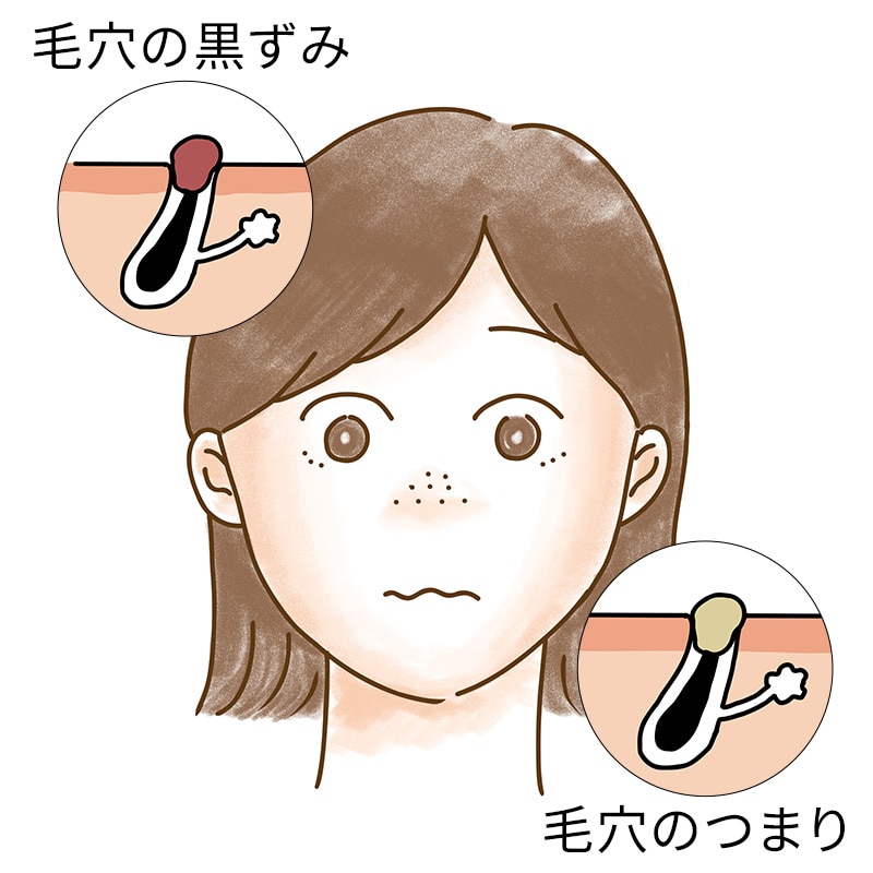 気になる毛穴悩み