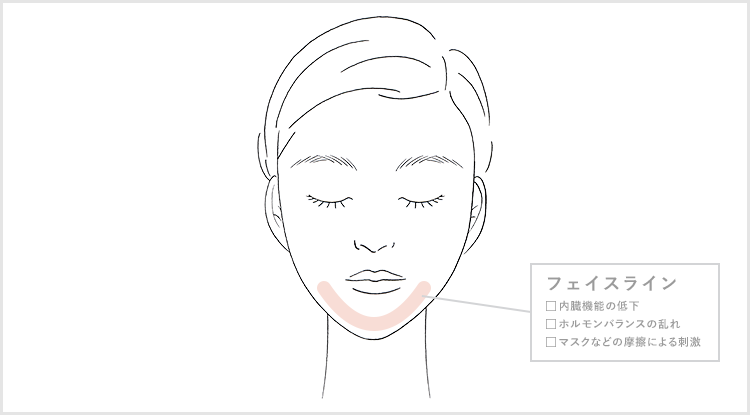 ニキビ