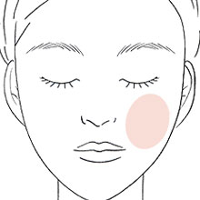 頬にできやすいニキビの原因と対策を紹介します。