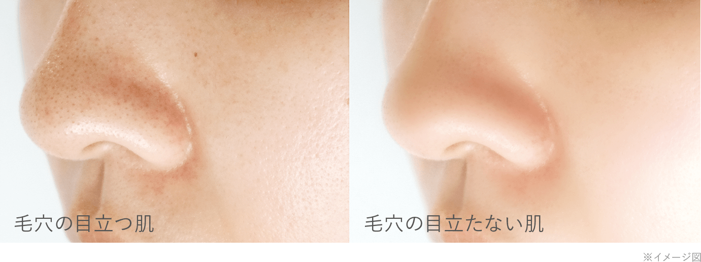 毛穴の目立つ肌と毛穴の目立たない肌の比較画像(※イメージ図)